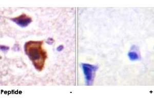 Immunohistochemical analysis of paraffin-embedded human brain tissue using C5AR1 polyclonal antibody . (C5AR1 Antikörper)