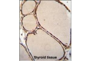 NFKBID Antibody (N-term) (ABIN655836 and ABIN2845251) immunohistochemistry analysis in formalin fixed and paraffin embedded human thyroid tissue followed by peroxidase conjugation of the secondary antibody and DAB staining. (NFKBID Antikörper  (N-Term))