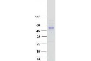 Validation with Western Blot (PAI1 Protein (Myc-DYKDDDDK Tag))