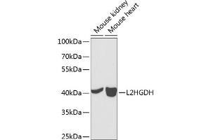Western blot analysis of extracts of various cell lines, using L2HGDH antibody (ABIN6132151, ABIN6143055, ABIN6143056 and ABIN6224014) at 1:1000 dilution.