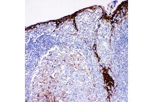 Anti-Cystatin A antibody, IHC(P) IHC(P): Human Tonsil Tissue (CSTA Antikörper  (C-Term))