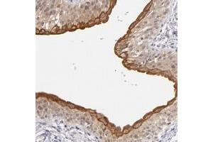 Immunohistochemical staining of human urinary bladder with C14orf135 polyclonal antibody  shows strong cytoplasmic positivity in urothelial cells at 1:20-1:50 dilution. (PCNXL4 Antikörper)