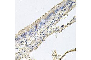 Immunohistochemistry of paraffin-embedded human trachea using EPOR antibody at dilution of 1:100 (x40 lens).