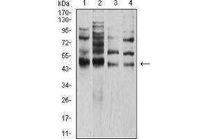 Western Blotting (WB) image for anti-Transcription Factor AP-2 alpha (Activating Enhancer Binding Protein 2 Alpha) (TFAP2A) (AA 105-211) antibody (ABIN5611192)