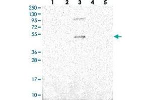 Western blot analysis of Lane 1: RT-4, Lane 2: U-251 MG, Lane 3: Human Plasma, Lane 4: Liver, Lane 5: Tonsil with SLC10A5 polyclonal antibody . (SLC10A5 Antikörper)