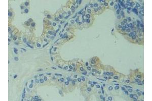Detection of CAPS in Human Prostate Tissue using Polyclonal Antibody to Calcyphosine (CAPS) (Calcyphosine Antikörper  (AA 1-189))