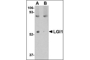 Western blot analysis of LGI1 in mouse brain tissue lysate with this product at 1 μg/ml in (A) the absence and (B) the presence of blocking peptide.