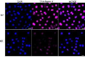 anti-Ligase IV, DNA, ATP-Dependent (LIG4) antibody