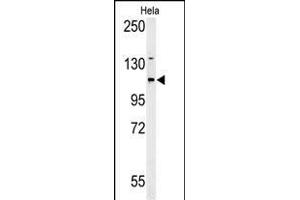 Western blot analysis of ADCY4 Antibody (Center)&65288,Cat(ABIN653832 and ABIN2843098)) in Hela cell line lysates (35 μg/lane). (ADCY4 Antikörper  (AA 415-441))