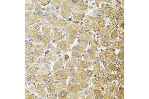 Immunohistochemistry of paraffin-embedded human liver injury using CEP164 antibody. (CEP164 Antikörper)