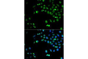 Immunofluorescence analysis of A549 cells using HOXA1 antibody (ABIN5974165). (HOXA1 Antikörper)