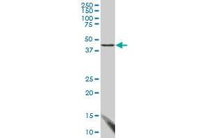 FBLIM1 monoclonal antibody (M03), clone 3F8. (FBLIM1 Antikörper  (AA 270-373))