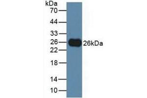 Detection of TIGIT in Rat Serum using Polyclonal Antibody to T-Cell Immunoreceptor With Ig And ITIM Domains Protein (TIGIT) (TIGIT Antikörper  (AA 28-227))