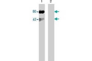 Western blot of Jurkat cells stimulated with calyculin A (100 nM, 30 min) (lane 1) followed by lambda phosphatase (lane 2) treatment. (DOK1 Antikörper  (pSer450))