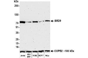Western Blotting (WB) image for anti-Bromodomain Containing 9 (BRD9) (AA 547-597) antibody (ABIN7455162)