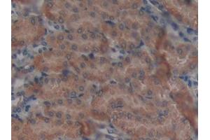 DAB staining on IHC-P; Samples: Mouse Kidney Tissue (GALNS Antikörper  (AA 168-377))