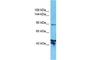 Host:  Rabbit  Target Name:  AXIN2  Sample Type:  Jurkat Whole Cell lysates  Antibody Dilution:  1. (AXIN2 Antikörper  (N-Term))