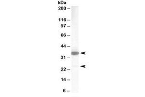 Western blot testing of human lung lysate with MCL1 antibody at 1ug/ml. (MCL-1 Antikörper)