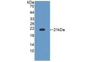 Detection of Recombinant ITGaM, Mouse using Polyclonal Antibody to Integrin Alpha M (CD11b) (CD11b Antikörper  (AA 248-430))