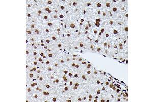 Immunohistochemistry of paraffin-embedded mouse liver using Phospho-NRF2-S40 Rabbit mAb (ABIN7268970) at dilution of 1:100 (40x lens). (NRF2 Antikörper  (pSer40))