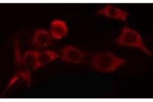 ABIN6275813 staining COLO205 cells by IF/ICC. (Cytochrome P450 4A11/22 Antikörper)