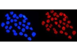 IF analysis of HnRNP A1 using anti-HnRNP A1 antibody (ABIN4886621). (HNRNPA1 Antikörper  (N-Term))