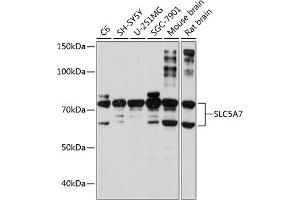Western blot analysis of extracts of various cell lines, using SLC5 Polyclonal Antibody (ABIN7267643) at 1:1000 dilution. (ChT Antikörper  (AA 421-580))