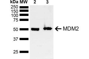 Western blot analysis of Mouse, Rat Brain showing detection of ~40 kDa MDM2 protein using Rabbit Anti-MDM2 Polyclonal Antibody (ABIN5668003). (MDM2 Antikörper  (AA 100-200) (Biotin))
