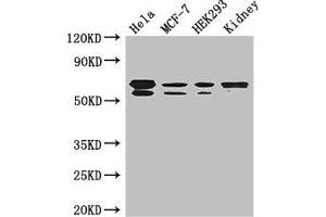 Western Blot Positive WB detected in: Hela whole cell lysate, MCF-7 whole cell lysate, HEK293 whole cell lysate, Mouse kidney tissue All lanes: RBPJ antibody at 3. (RBPJ Antikörper  (AA 243-485))