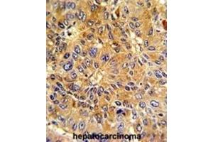 Immunohistochemistry (IHC) image for anti-Cyclin A2 (CCNA2) antibody (ABIN3003117)