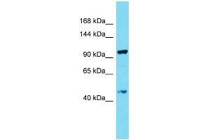 Host: Rabbit Target Name: CCDC135 Sample Type: THP-1 Whole Cell lysates Antibody Dilution: 1.
