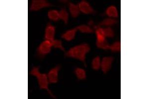 ABIN6269180 staining COS7 by IF/ICC. (Phospholipase C gamma 1 Antikörper)