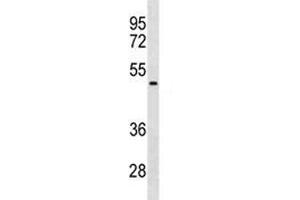 NEU1 antibody western blot analysis in HepG2 lysate. (NEU1 Antikörper  (AA 188-214))