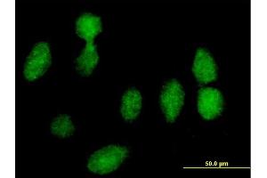 Immunofluorescence of purified MaxPab antibody to RPLP0 on HeLa cell. (RPLP0 Antikörper  (AA 1-317))