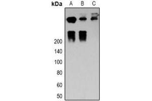 Western blot analysis of Desmoplakin expression in MCF7 (A), Hela (B), mouse heart (C) whole cell lysates. (Desmoplakin Antikörper)