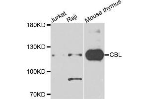Western blot analysis of extracts of various cell lines, using CBL antibody (ABIN5995395) at 1/1000 dilution. (CBL Antikörper)