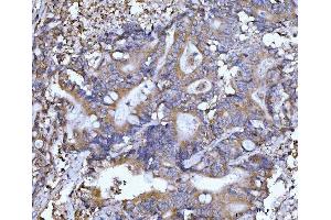 IHC analysis of Beclin 1 using anti-Beclin 1 antibody (ABIN7599303).