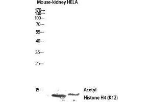 Western Blot (WB) analysis of Mouse Kidney HeLa lysis using Acetyl-Histone H4 (K12) antibody. (Histone H4 Antikörper  (acLys12))