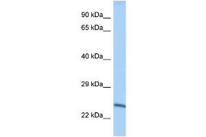 WB Suggested Anti-Mettl10 Antibody Titration: 1. (METTL10 Antikörper  (Middle Region))