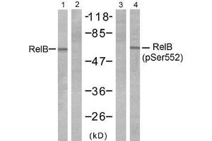 Western blot analysis of extracts from A431 cells, untreated or treated with EGF (200ng/ml 10min), using RelB (Ab-552) antibody (E021247, Line 1 and 2) and RelB (phospho- Ser552) antibody (E011255, Line 3 and 4). (RELB Antikörper  (pSer552))