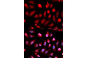 Immunofluorescence analysis of U2OS cells using EZH2/KMT6 antibody (ABIN6133509, ABIN6140393, ABIN6140396 and ABIN6215059). (EZH2 Antikörper  (AA 1-250))