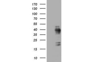 Image no. 1 for anti-Antigen Identified By Monoclonal Antibody Ki-67 (MKI67) (AA 1160-1493) antibody (ABIN1490860) (Ki-67 Antikörper  (AA 1160-1493))