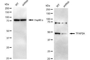 Western blotting analysis using TFAP2A antibody (ABIN7800591).