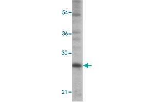 Western blot analysis of PC-3 cells with TICAM2 polyclonal antibody  at 1 ug/mL dilution. (TICAM2 Antikörper  (C-Term))
