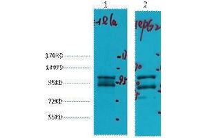 Western Blotting (WB) image for anti-Insulin-Degrading Enzyme (IDE) antibody (ABIN3178636) (IDE Antikörper)