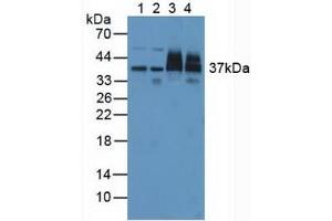 Figure. (PSMD7 Antikörper  (AA 1-324))