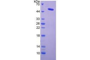 Lysyl Oxidase (LOX) (AA 213-417) (Active) protein (His tag,GST tag)