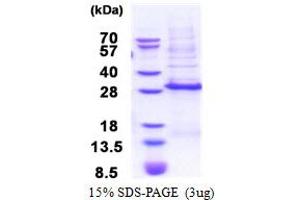 SDS-PAGE (SDS) image for Distal-Less Homeobox 3 (DLX3) (AA 1-186) protein (His tag) (ABIN5853443)
