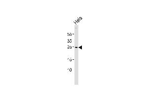 Western blot analysis of lysate from Hela cell line, using ZNRF2 Antibody (N-term) (ABIN6242713 and ABIN6577528). (ZNRF2 Antikörper  (N-Term))