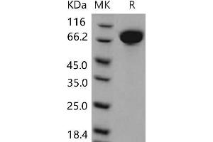 Western Blotting (WB) image for Mast/stem Cell Growth Factor Receptor (KIT) (Active) protein (His tag) (ABIN7320245) (KIT Protein (His tag))